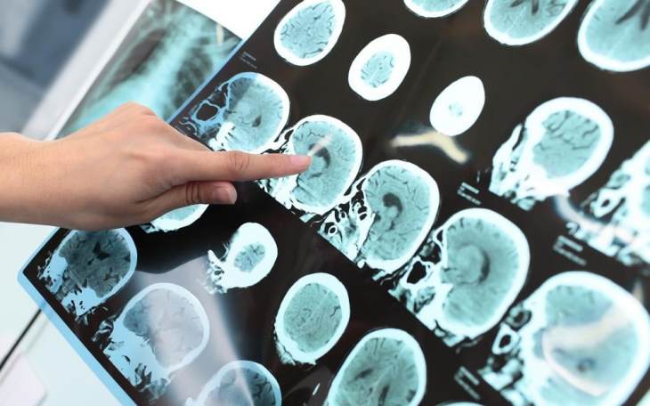 &Pi;ώ&sigmaf; &tau;&alpha; &kappa;&iota;&nu;&eta;&tau;ά ά&lambda;&lambda;&alpha;&xi;&alpha;&nu; &tau;&omicron;&nu; &epsilon;&gamma;&kappa;έ&phi;&alpha;&lambda;ό &mu;&alpha;&sigmaf;