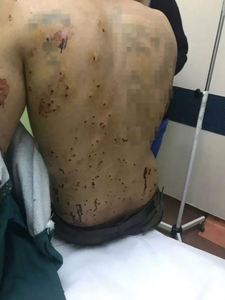 &Tau;&eta; &Delta;&epsilon;&upsilon;&tau;έ&rho;&alpha; &eta; &alpha;&pi;&omicron;&lambda;&omicron;&gamma;ί&alpha; &tau;&omicron;&upsilon; 55&chi;&rho;&omicron;&nu;&omicron;&upsilon; &pi;&omicron;&upsilon; &pi;&upsilon;&rho;&omicron;&beta;ό&lambda;&eta;&sigma;&epsilon; &mu;&epsilon;&tau;&alpha;&nu;ά&sigma;&tau;&epsilon;&sigmaf; &sigma;&tau;&eta; &Lambda;έ&sigma;&beta;&omicron;