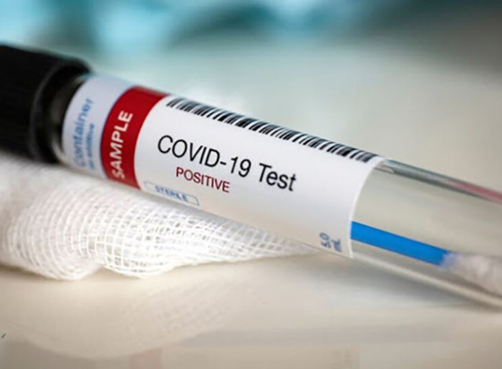 &Omicron; &chi;ά&rho;&tau;&eta;&sigmaf; &tau;&omicron;&upsilon; &kappa;&omicron;&rho;&omega;&nu;&omicron;ϊ&omicron;ύ &sigma;&tau;&eta;&nu; &Epsilon;&lambda;&lambda;ά&delta;&alpha;- 3 &kappa;&rho;&omicron;ύ&sigma;&mu;&alpha;&tau;&alpha; &sigma;&tau;&eta;&nu; &Pi;.&Epsilon;. &Rho;ό&delta;&omicron;&upsilon;, 1 &kappa;&rho;&omicron;ύ&sigma;&mu;&alpha; &sigma;&tau;&eta;&nu; &Pi;.&Epsilon;. &Kappa;&alpha;&lambda;ύ&mu;&nu;&omicron;&upsilon;, &sigma;&tau;&eta;&nu; &Lambda;έ&rho;&omicron;