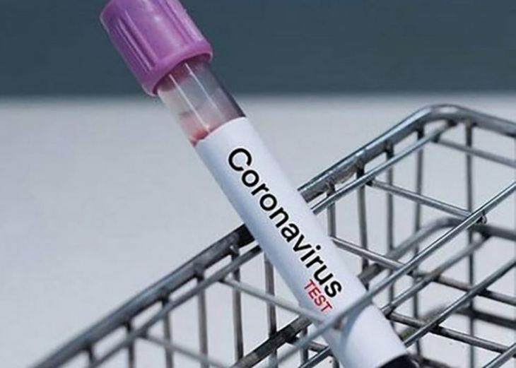 &Alpha;&nu;&alpha;&kappa;&omicron;ί&nu;&omega;&sigma;&eta; &tau;&omicron;&upsilon; &Epsilon;&Iota; &Pi;&Alpha;&Sigma;&Tau;&Epsilon;&Rho;, &sigma;&chi;&epsilon;&tau;&iota;&kappa;ά &mu;&epsilon; &tau;&omicron; &pi;&rho;ό&beta;&lambda;&eta;&mu;&alpha; &pi;&omicron;&upsilon; &delta;&eta;&mu;&iota;&omicron;&upsilon;&rho;&gamma;ή&theta;&eta;&kappa;&epsilon; &sigma;&epsilon; &alpha;&pi;&omicron;&tau;&epsilon;&lambda;έ&sigma;&mu;&alpha;&tau;&alpha; &tau;&epsilon;&sigma;&tau; &gamma;&iota;&alpha; &tau;&omicron;&nu; Covid- 19